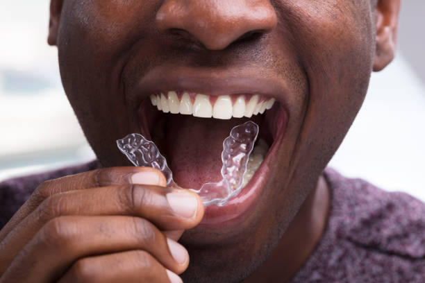 Invisalign photo